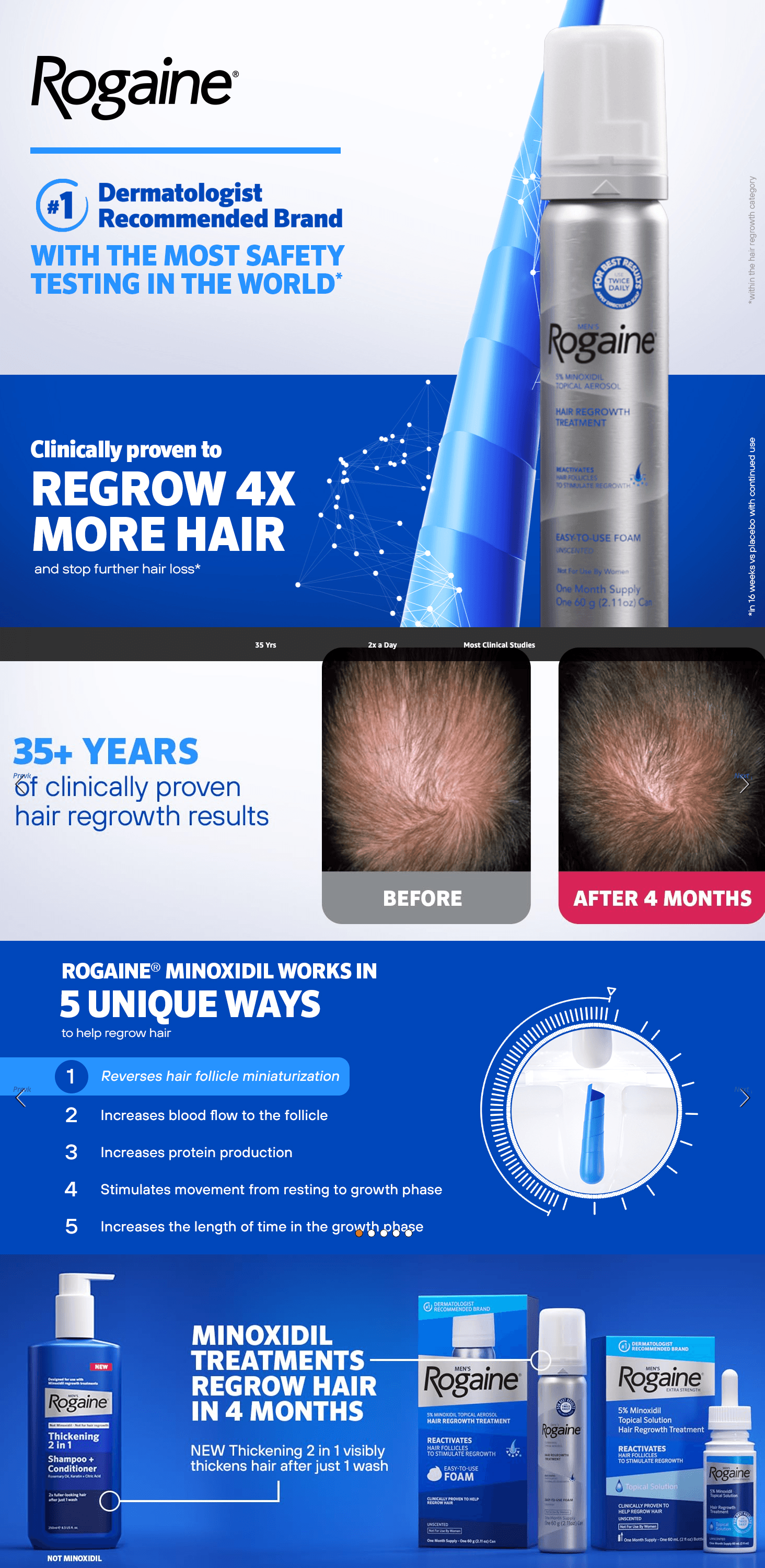 Amazon.com: Men's Rogaine 5% Minoxidil Foam for Hair Regrowth: A+ Premium