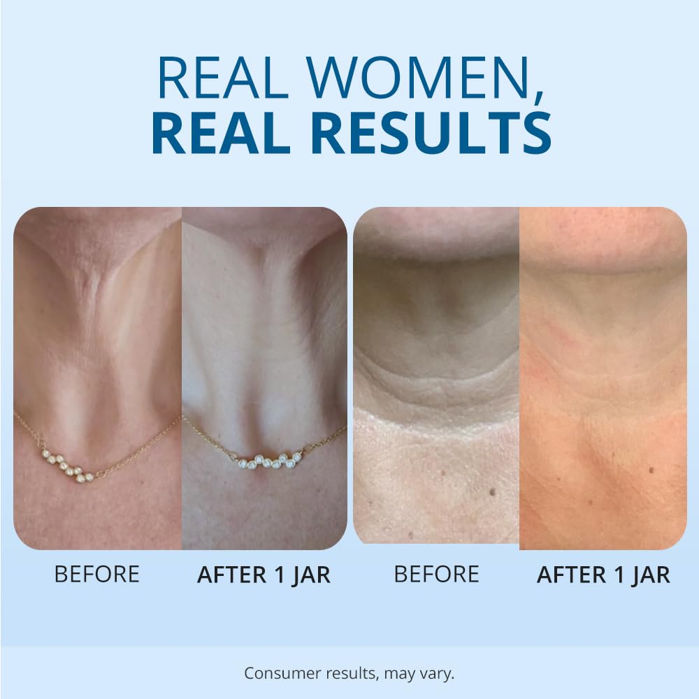 Amazon.com: goPure Tighten & Lift Neck Firming Cream: Infographics