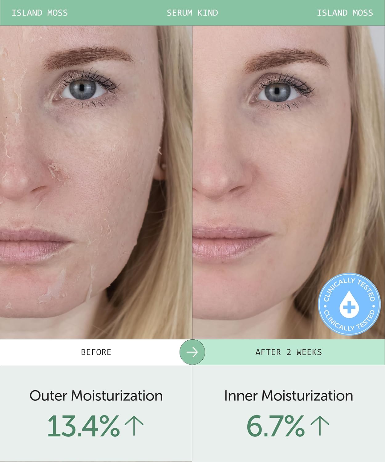 Amazon.com: SERUMKIND Iceland Moss Serum: Infographics