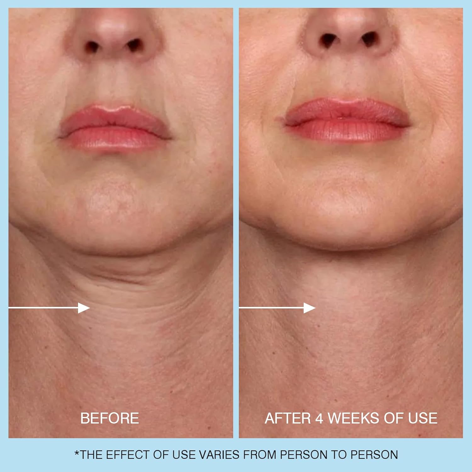 Amazon.com: UJhay Retinol Neck Cream: Infographics