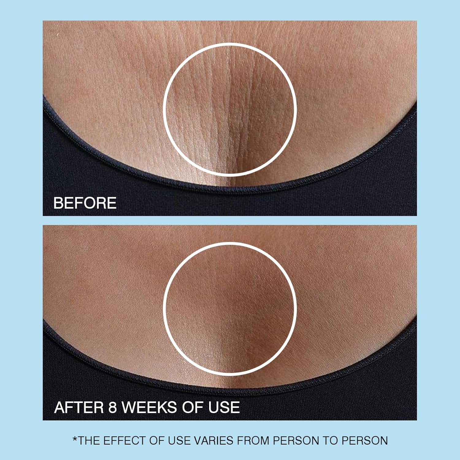 Amazon.com: UJhay Retinol Neck Cream: Infographics