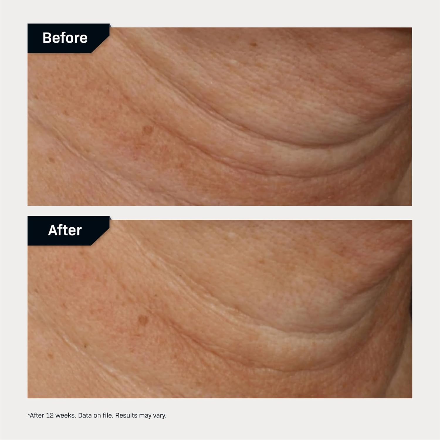 Amazon.com: Revision Skincare Nectifirm® Advanced: Infographics