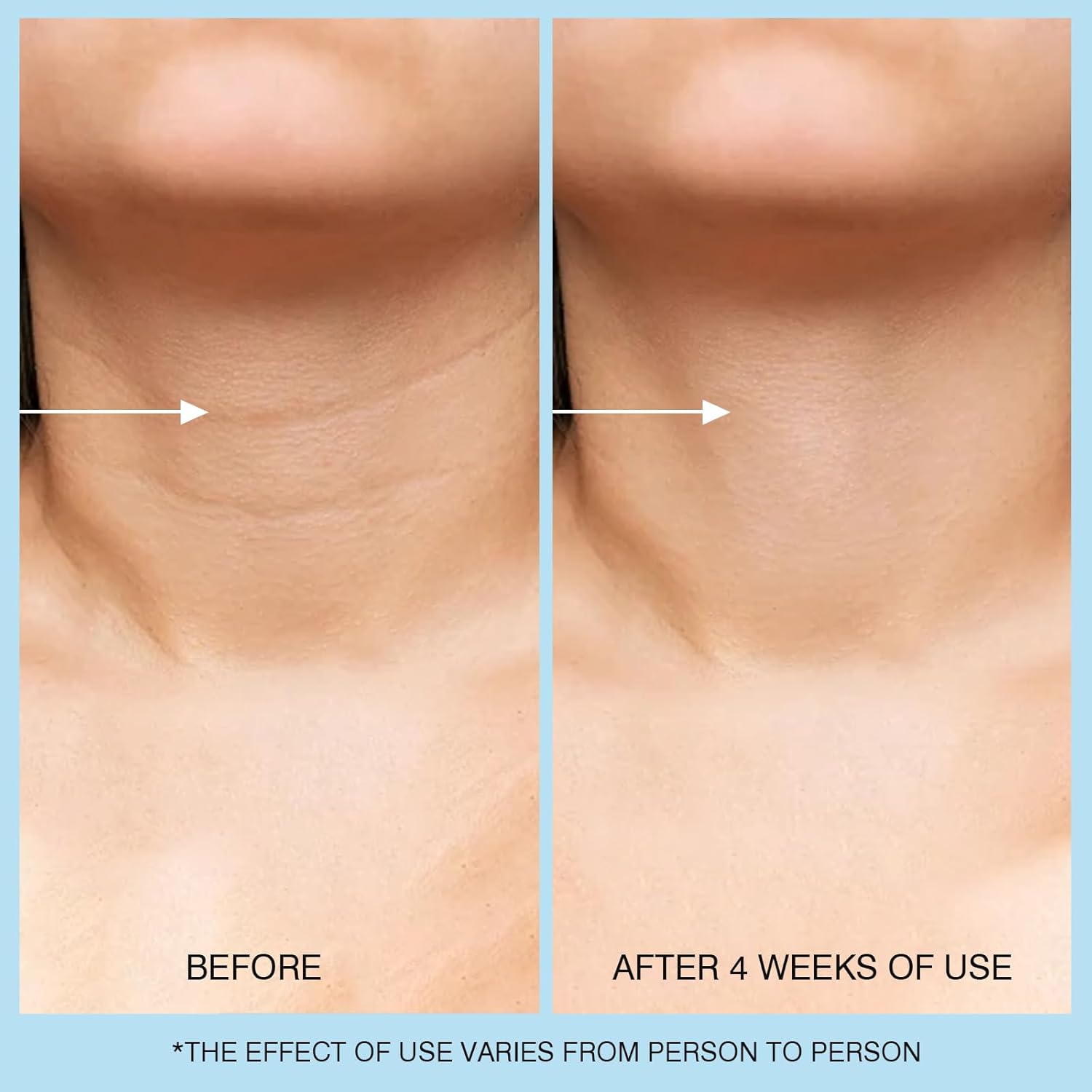 Amazon.com: UJhay Retinol Neck Cream: Infographics