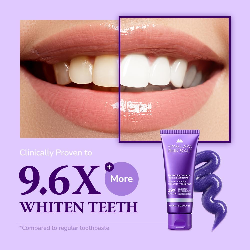 Amazon.com: HIMALAYA PINKSALT Purple Whitening Toothpaste: Infographics