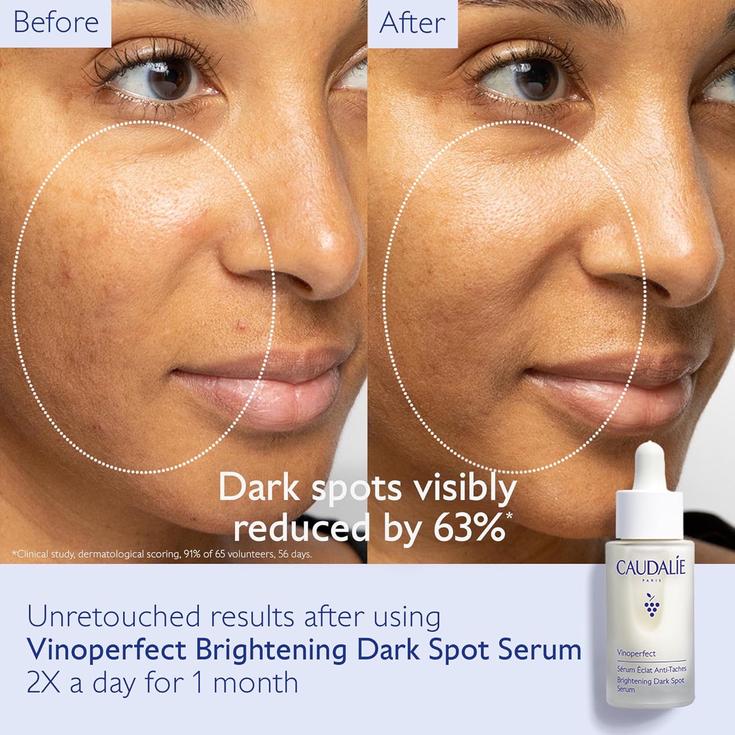 Amazon.com: Caudalie Vinoperfect Brightening Dark Spot Serum: Infographics