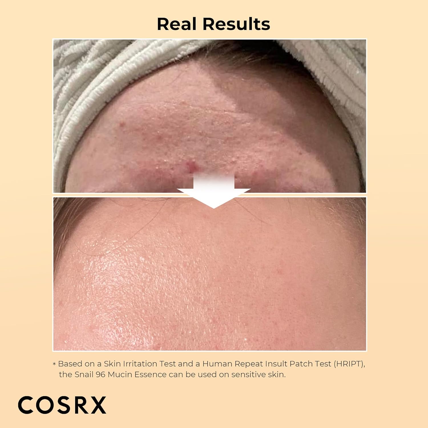 Amazon.com: COSRX Snail Mucin 96% Power Repairing Essence 3.38 fl.oz 100ml: Infographics