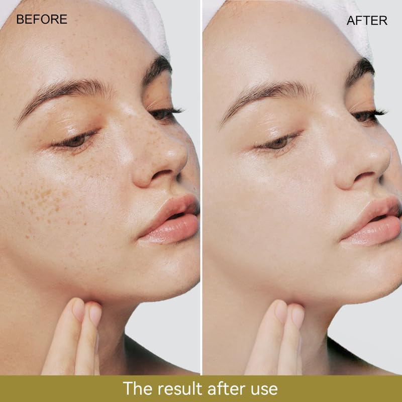 Amazon.com: Snail Mucin Serum 96% Snail Secretion Filtrate: Infographics