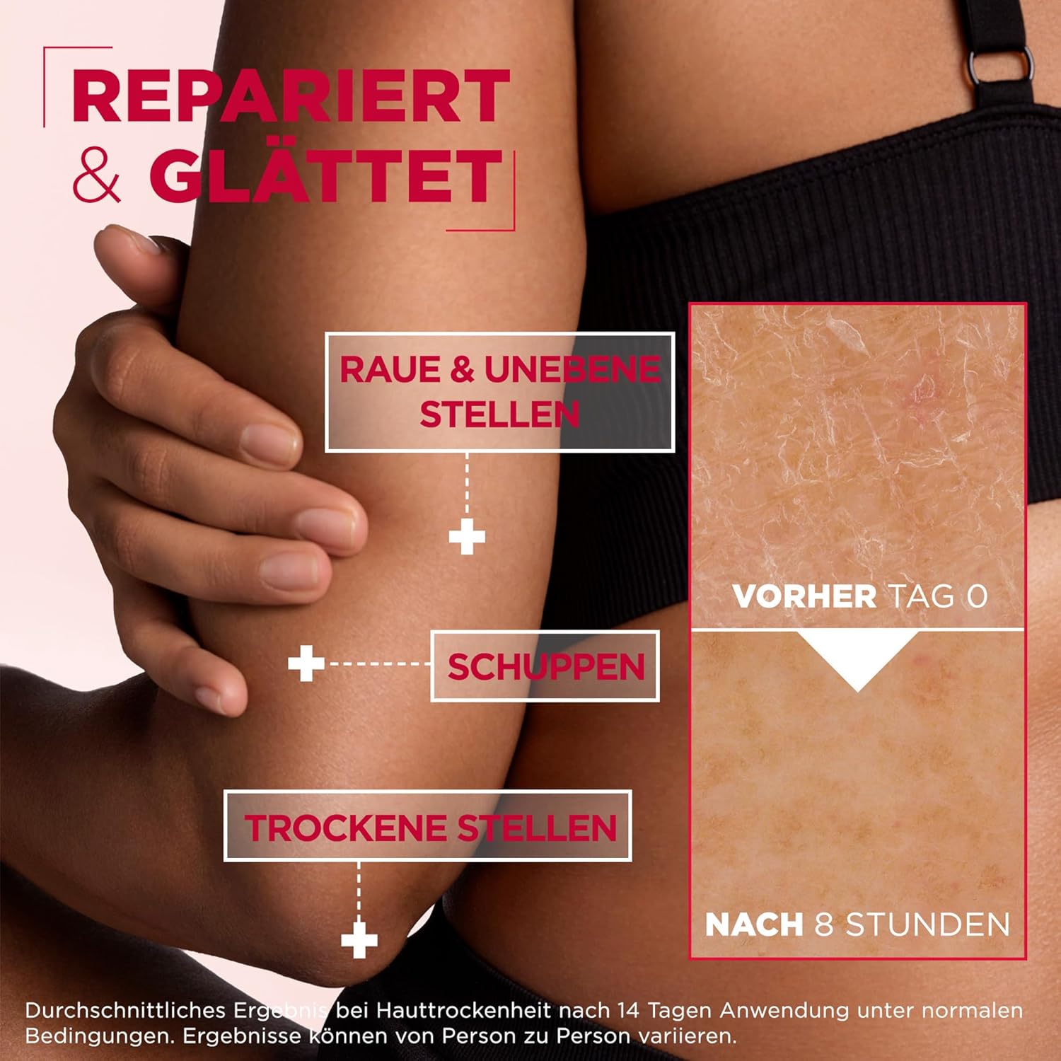 Mixa Urea Skin Renewing Cream with Urea & Niacinamide for Dry and Rough and Uneven Skin: Infographics
