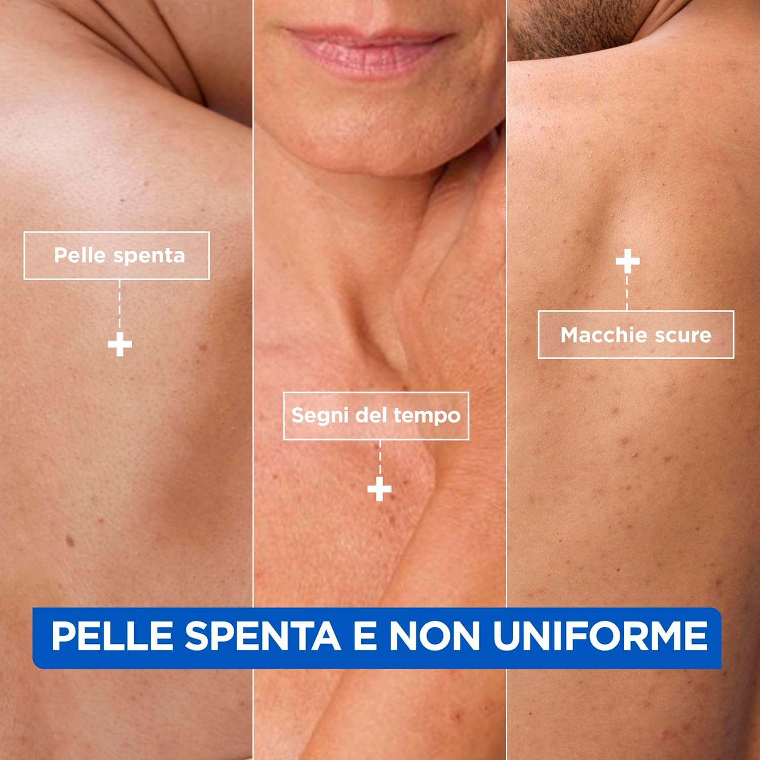 Mixa Anti-Stain Moisturising Cream for Dry and Dull Skin: Product Anatomy Secondary Images