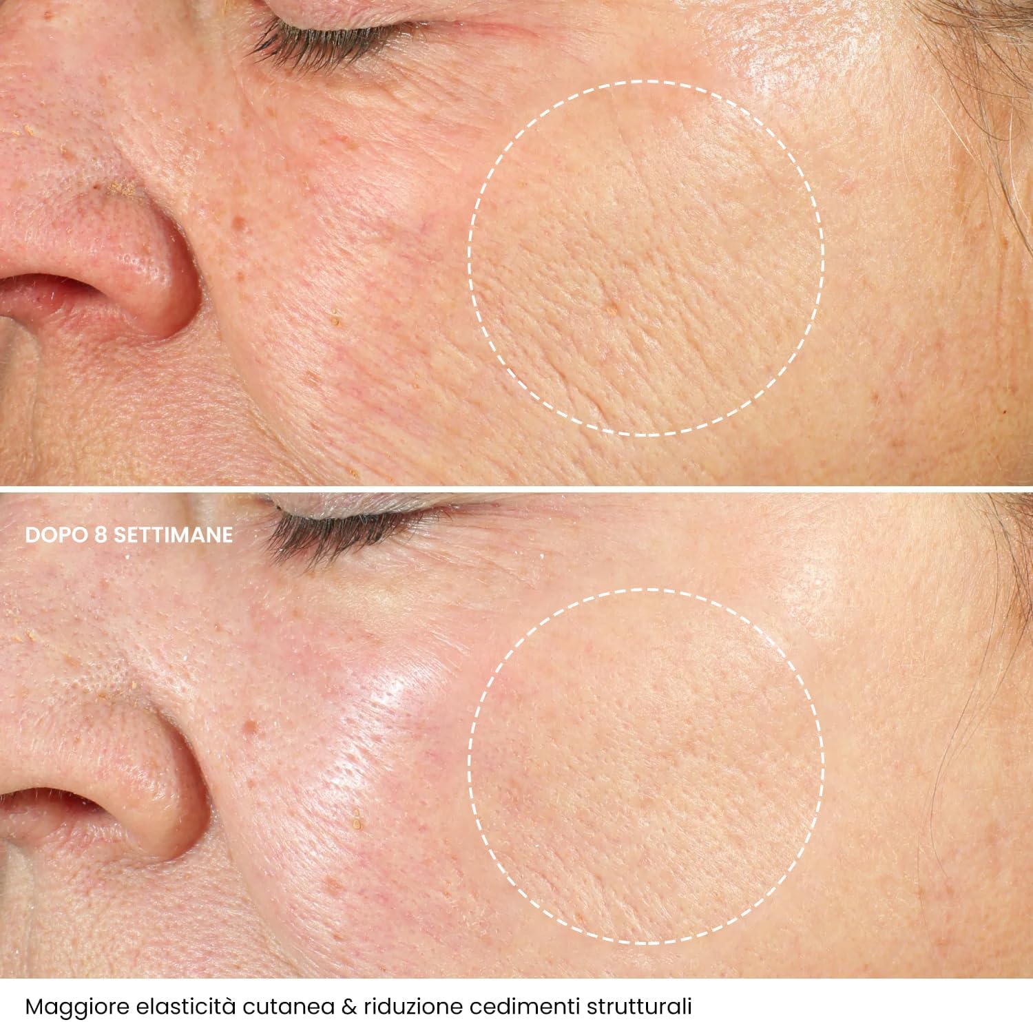 Anti-Wrinkle Face Cream Hyaluronic Acid with Retinol and Collagen: Single Feature / Benefit Secondary Images