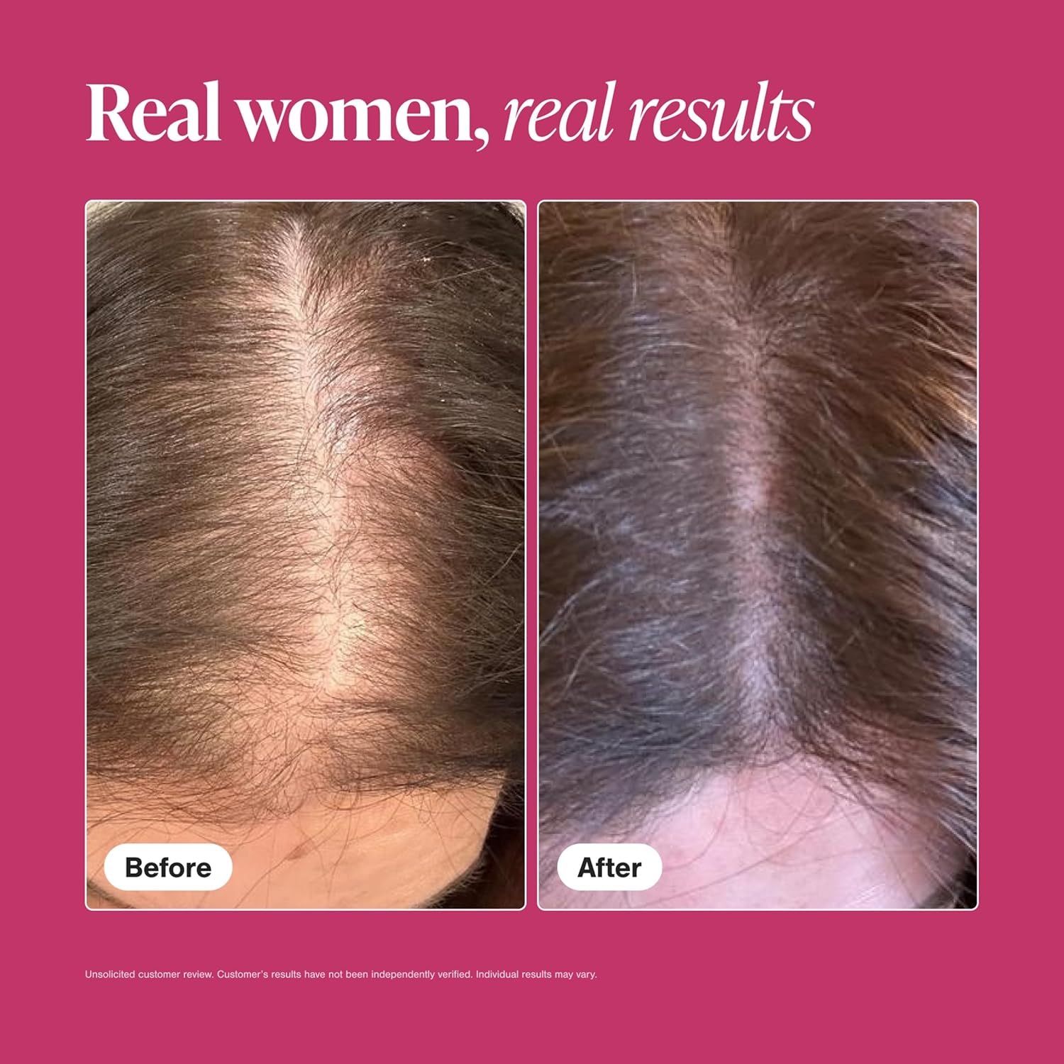 Visually demonstrates the effectiveness of the product by showing a before and after comparison of hair regrowth.
