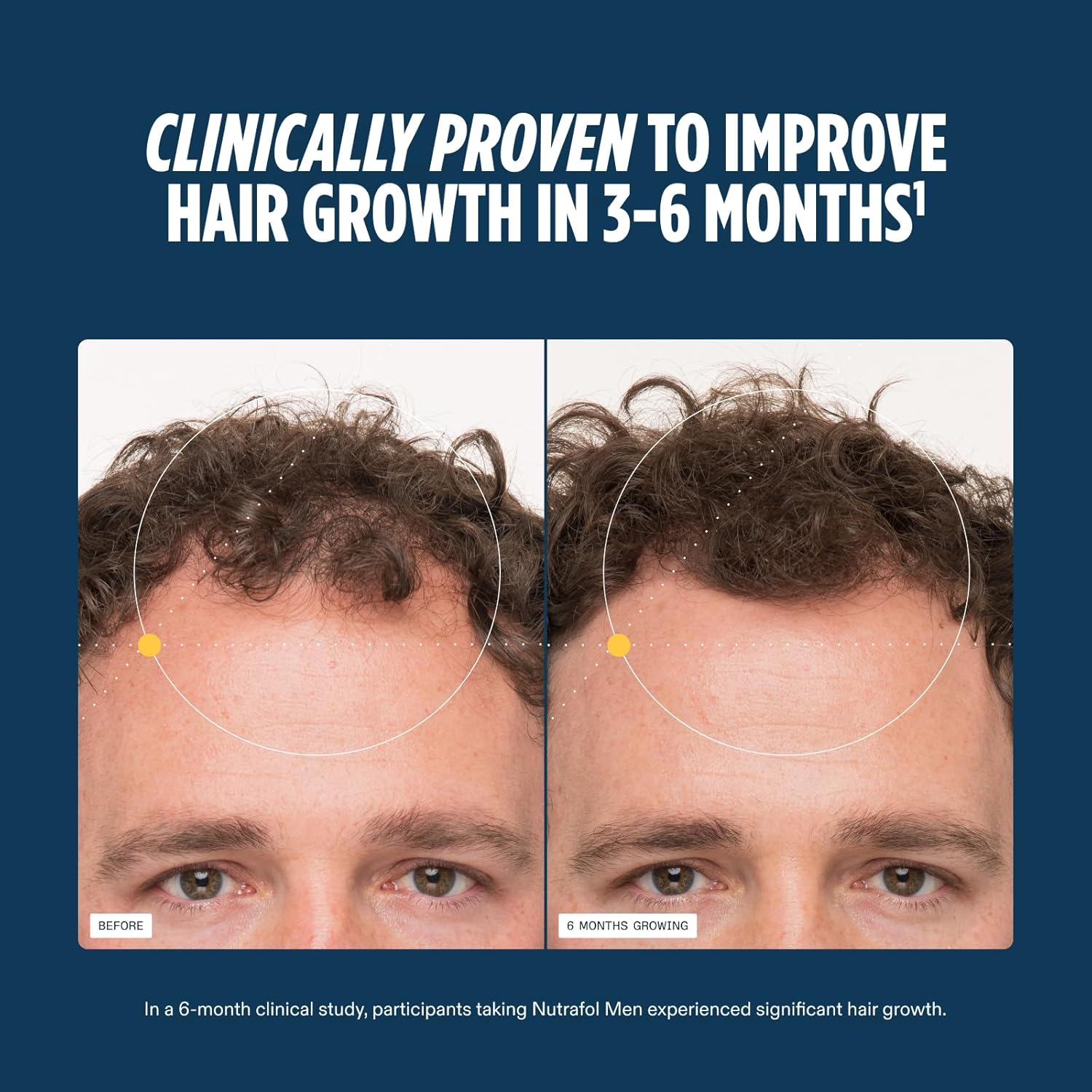 Visually demonstrates the product's effectiveness in promoting hair growth over a 6-month period.