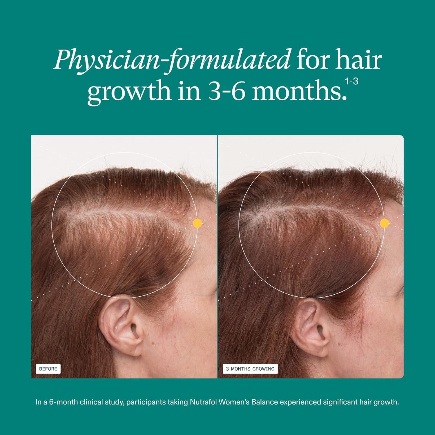 Visually demonstrates the product's effectiveness in promoting hair growth over a 3-month period.