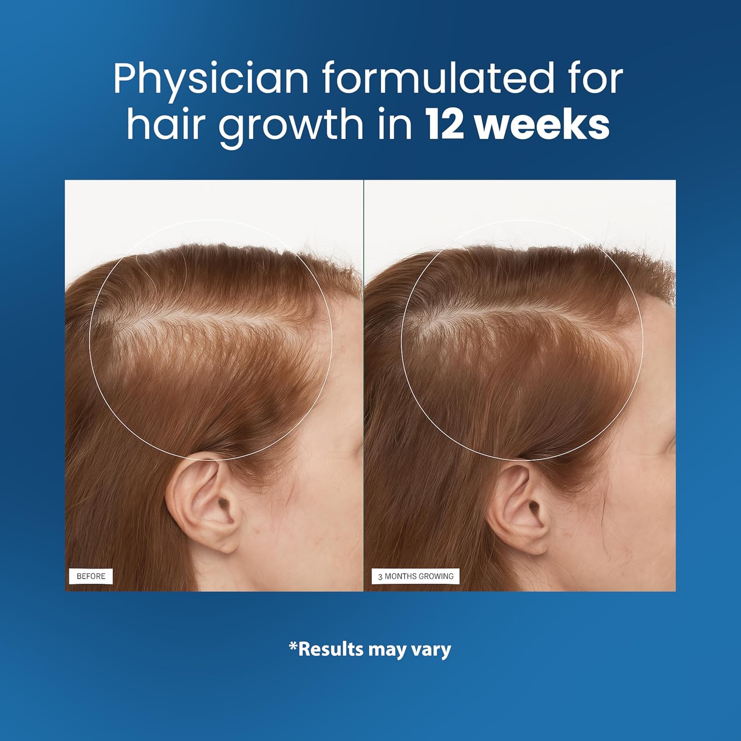 Visually demonstrates the product's effectiveness in promoting hair growth over a 12-week period.
