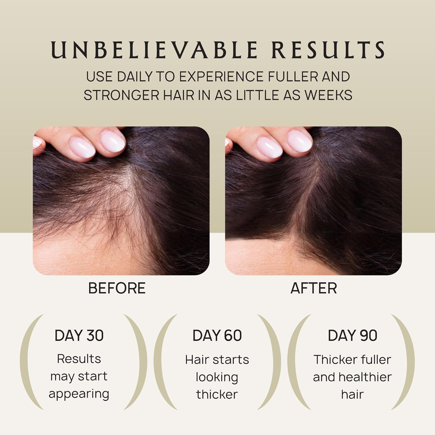 Visually demonstrates the product's effectiveness in promoting fuller and thicker hair growth over time.