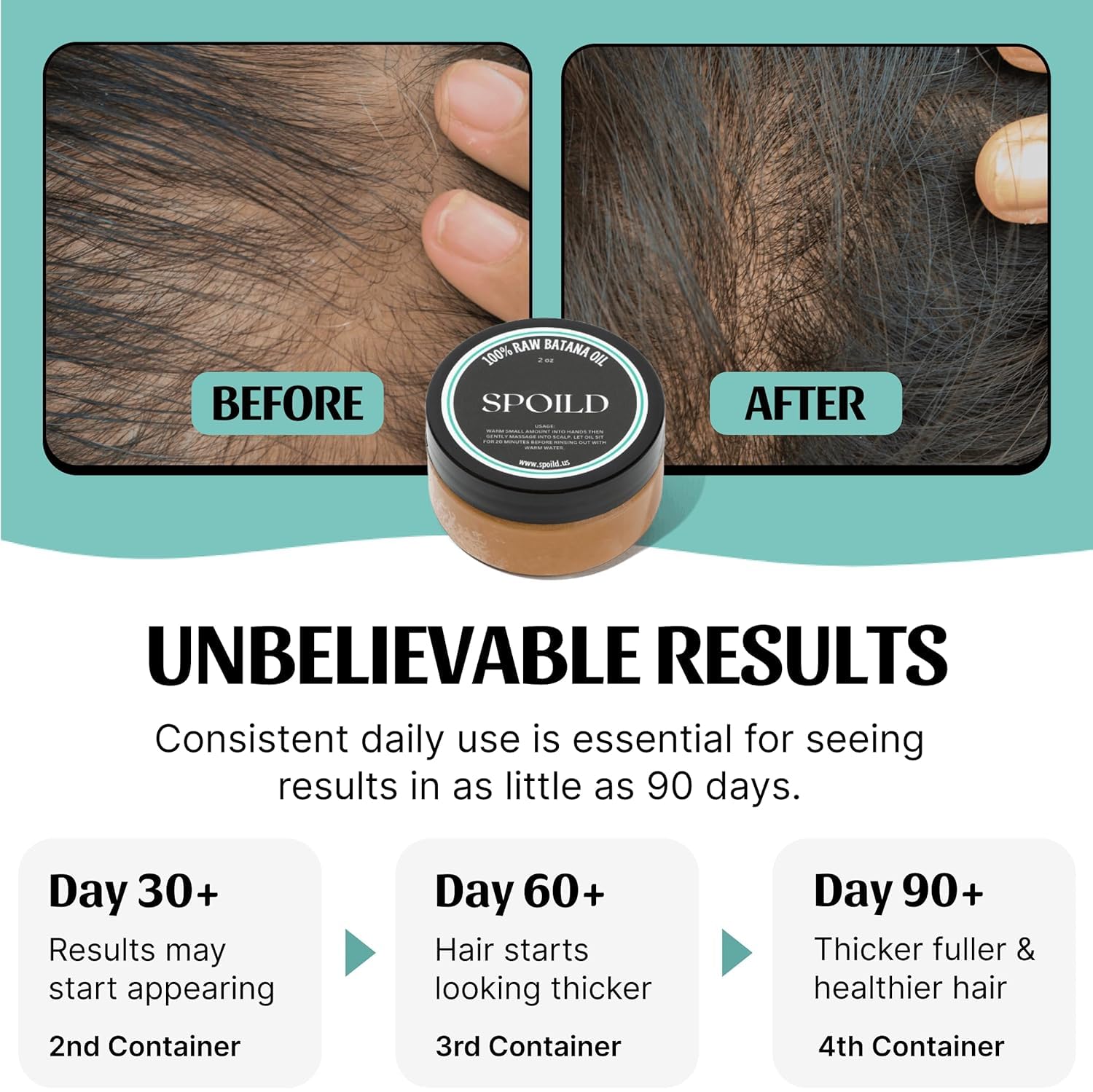 Visually demonstrates the product's effectiveness in promoting hair regrowth and achieving thicker, fuller hair over time.