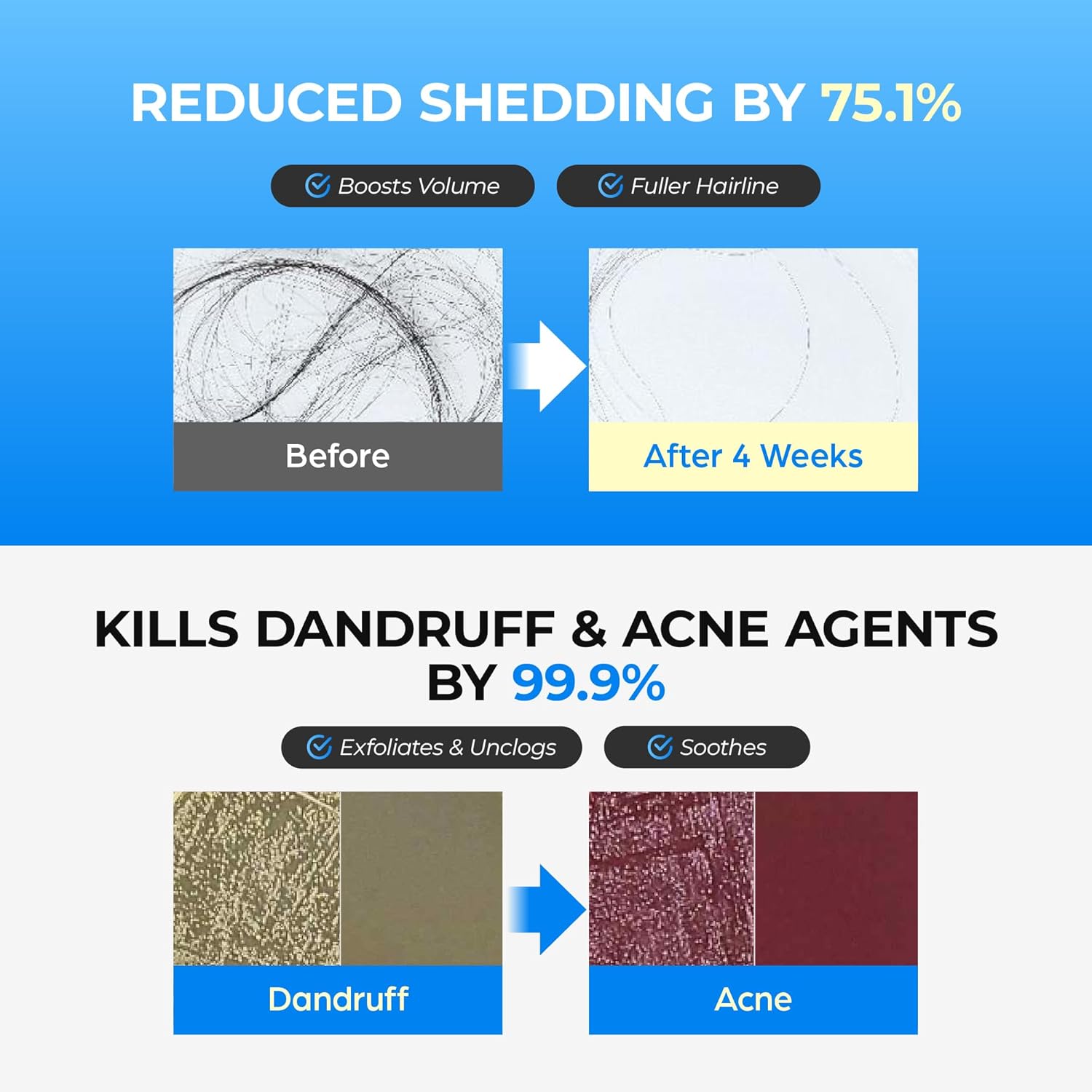 Showcases multiple benefits of the product through before/after comparisons and quantified claims to demonstrate its effectiveness in reducing hair shedding, boosting volume, treating dandruff and…