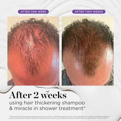 Visually demonstrates the effectiveness of the hair thickening shampoo and treatment by showing the transformation in hair density and regrowth over a 2-week period.
