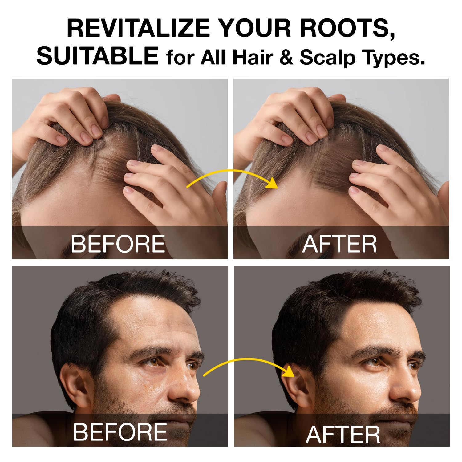 Visually demonstrates the product's effectiveness in revitalizing hair roots and promoting hair regrowth for both men and women.
