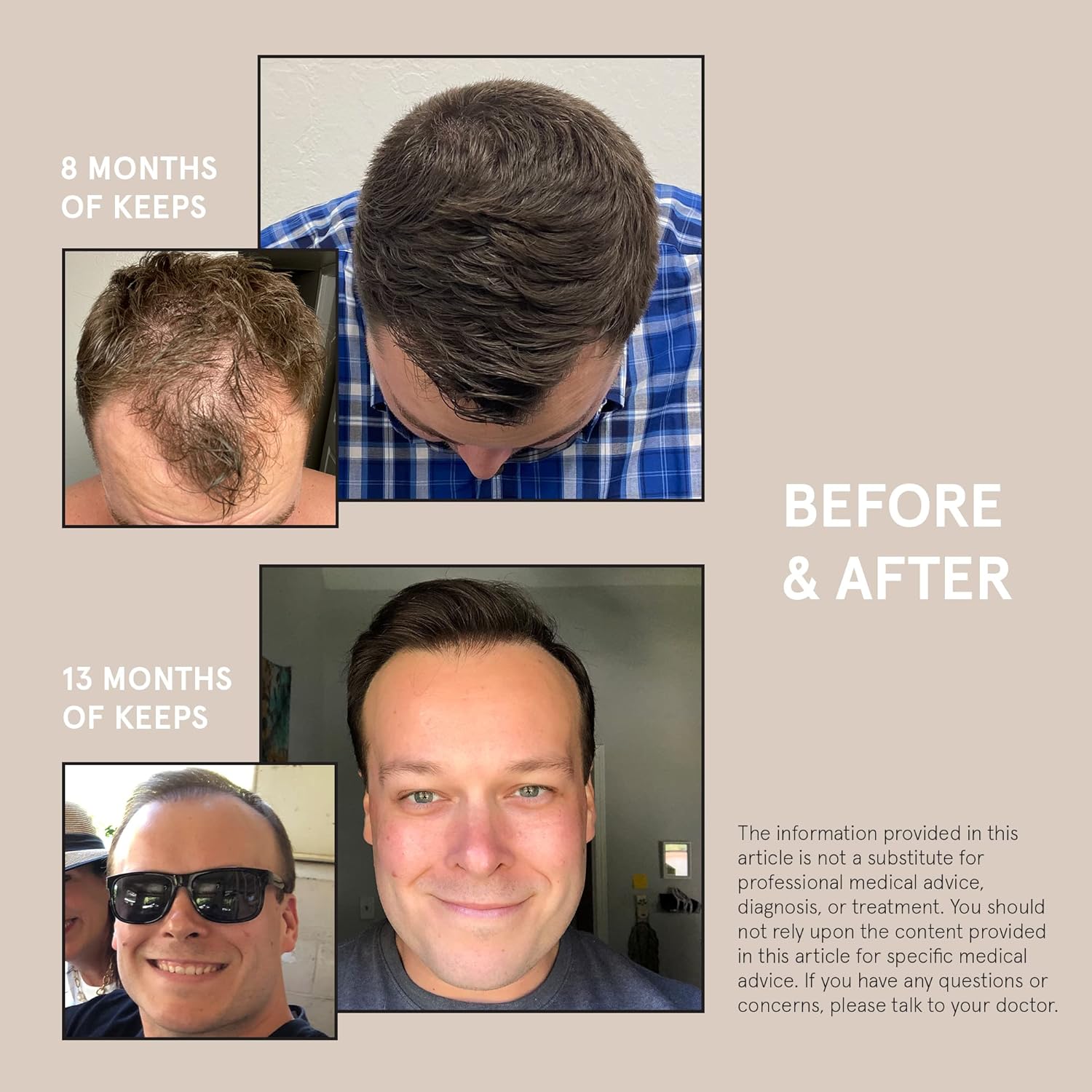 Visually demonstrates the effectiveness of the product by showing the transformation in hair regrowth over time.