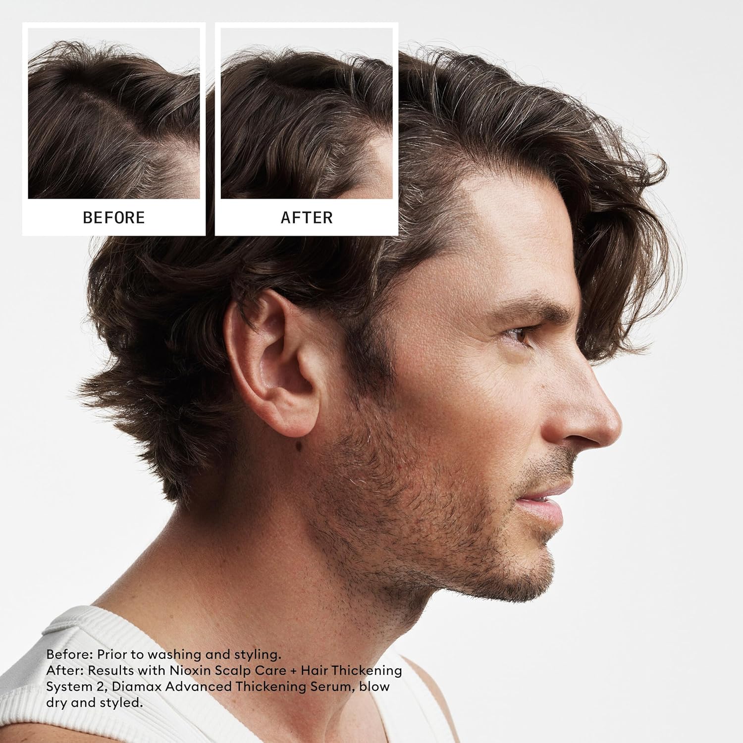 Visually demonstrates the hair thickening and volumizing results achieved by using the Nioxin Scalp Care and Hair Thickening System.