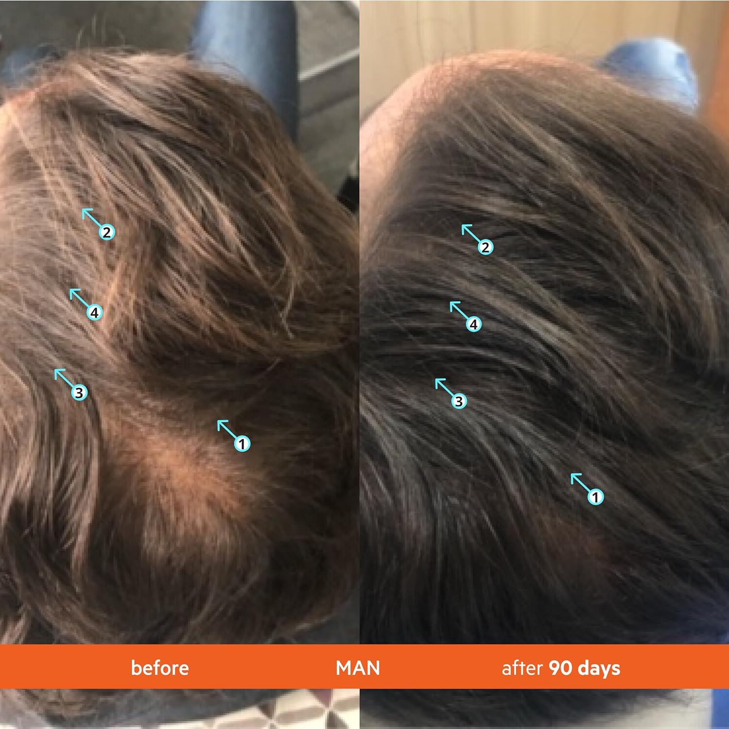 Visually demonstrates the product's effectiveness in promoting hair regrowth and increasing hair thickness over a 90-day period.