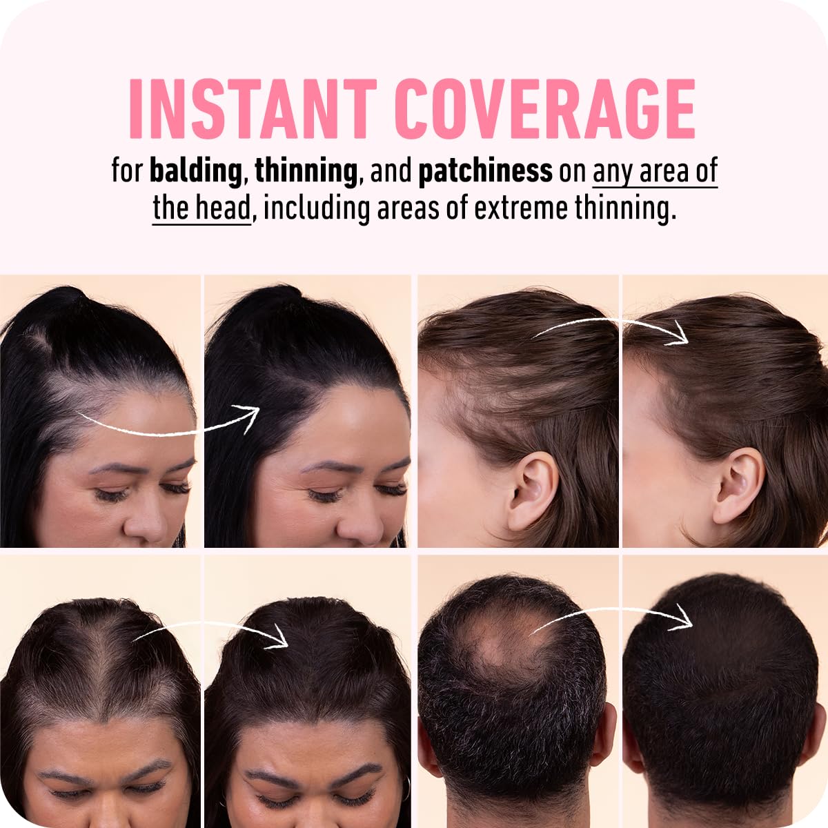 Highlights the product's ability to provide instant coverage for various hair thinning and balding issues, reassuring customers of its effectiveness.