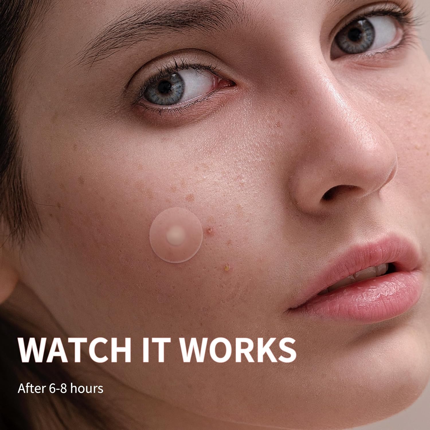 Demonstrates the effectiveness of the product in treating acne by showing a clear patch on a blemish, implying it will reduce or eliminate the spot.