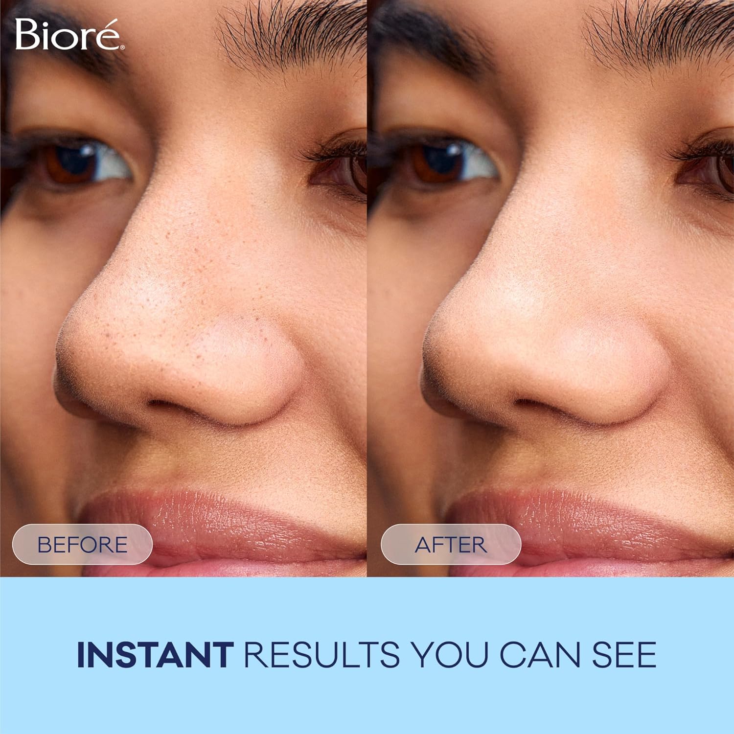 Demonstrates the immediate visible effect of the product in reducing the appearance of pores on the skin.