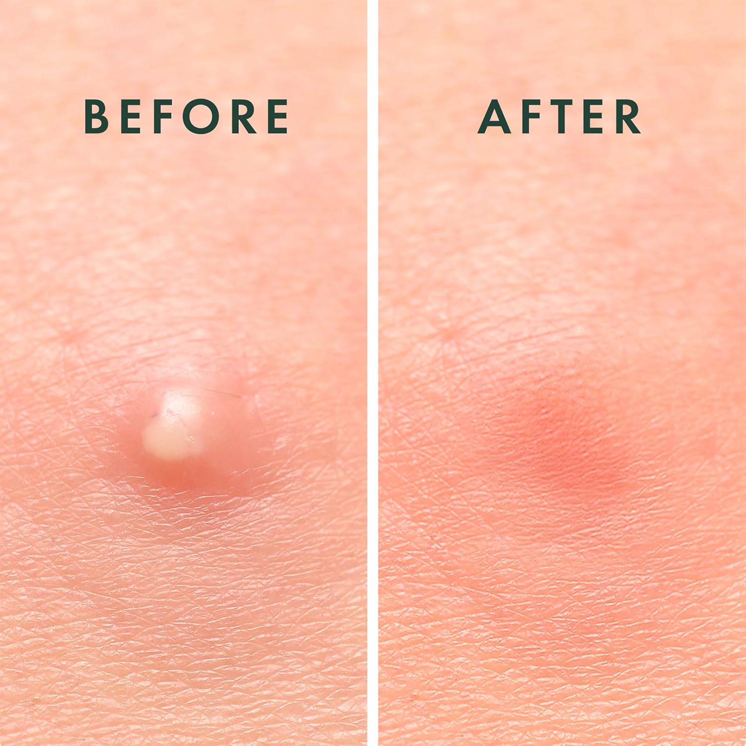 Demonstrates the effectiveness of the product in removing skin blemishes or imperfections.