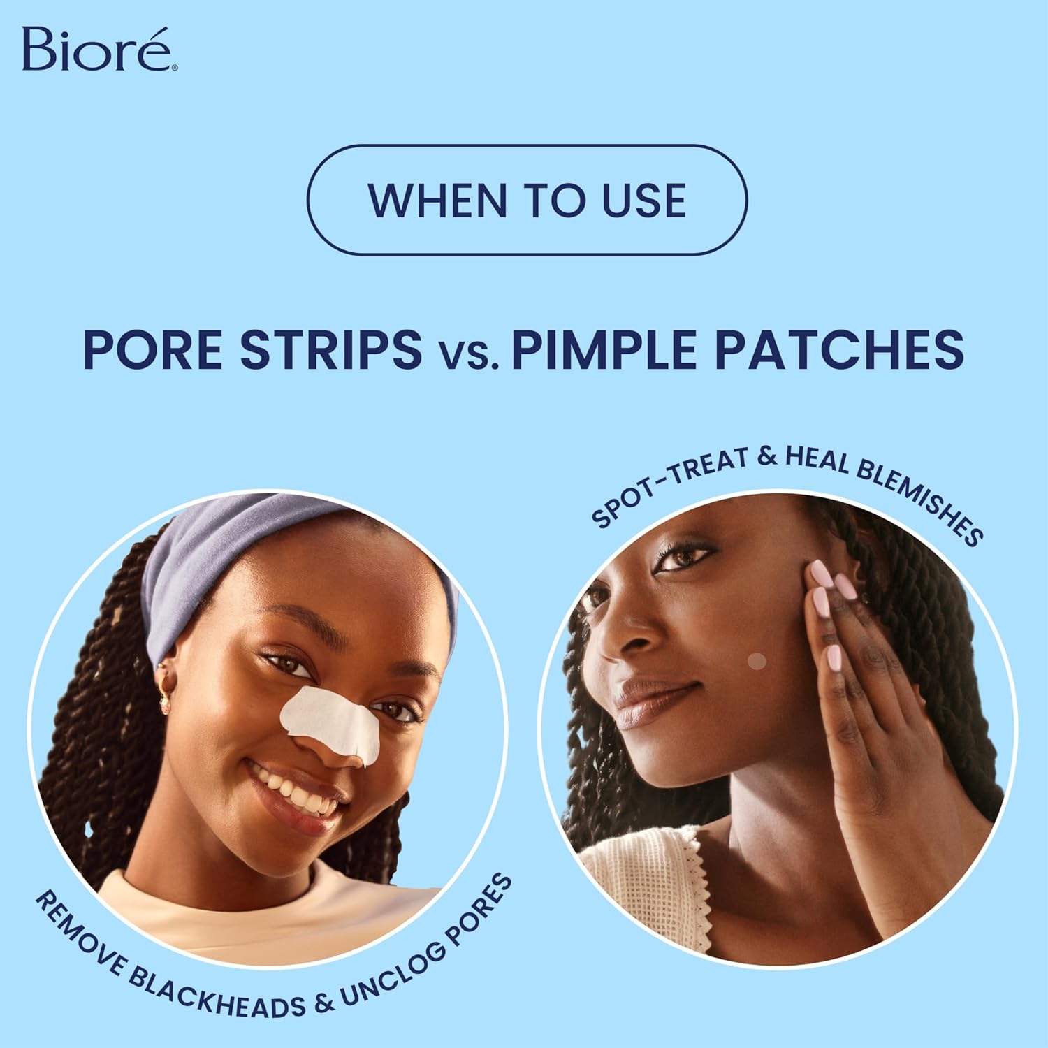 Guides customers on when to use pore strips versus pimple patches for different skin concerns.