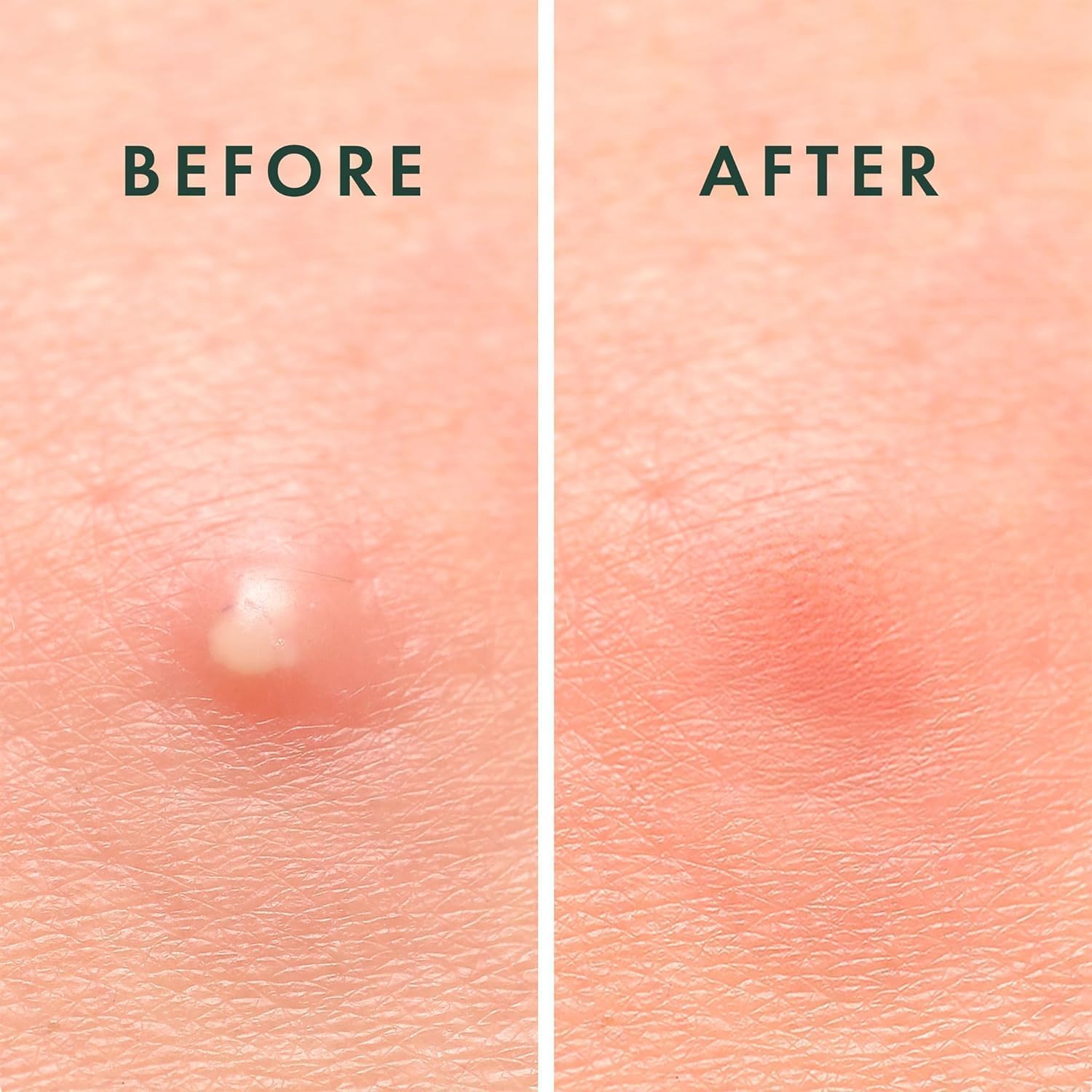 Demonstrates the effectiveness of the product in removing skin blemishes or imperfections.