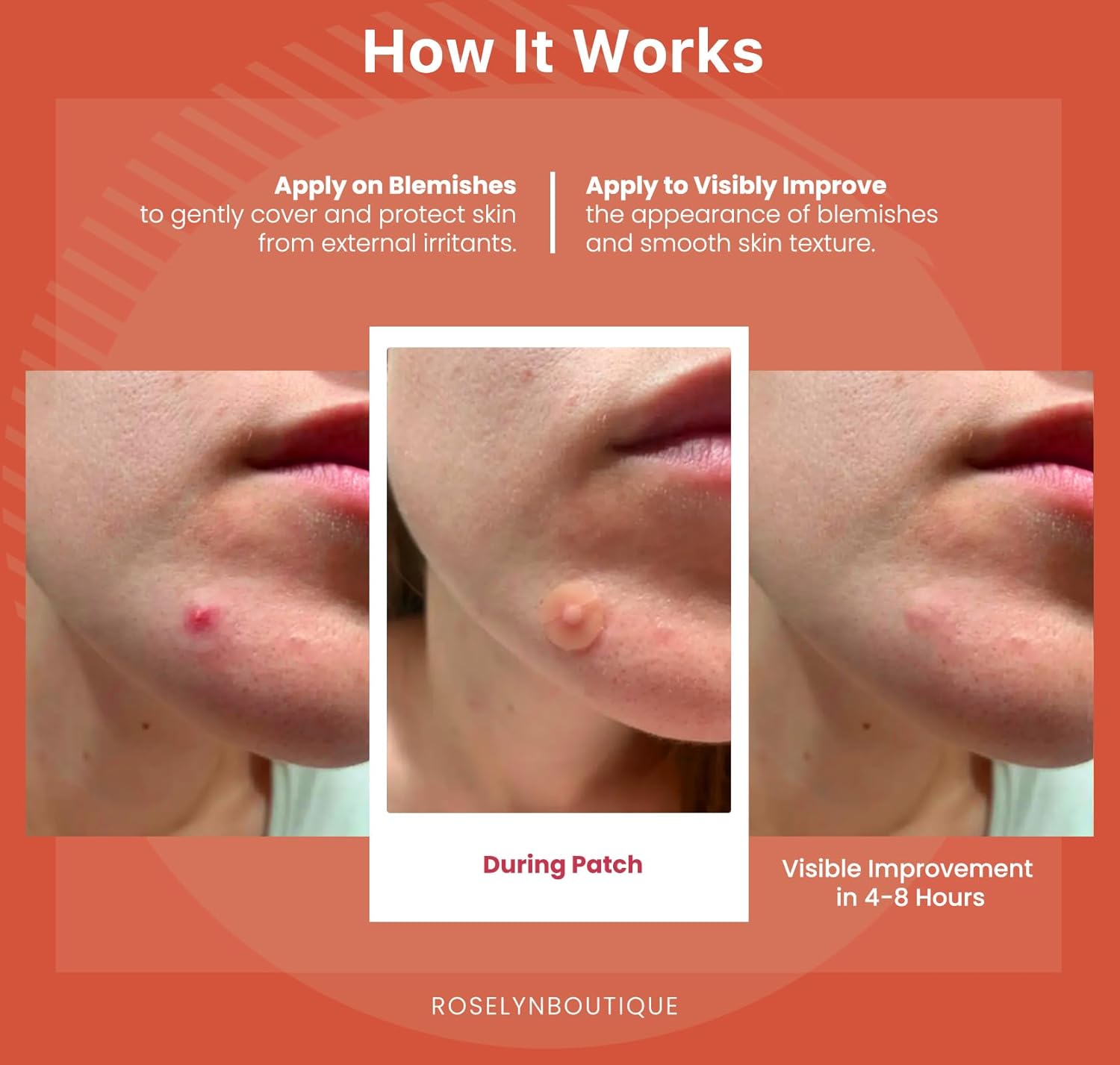 Demonstrates the process and effectiveness of applying the product to treat skin blemishes, showing visible improvement over time. Visually proves the product's effectiveness by showing the skin's…