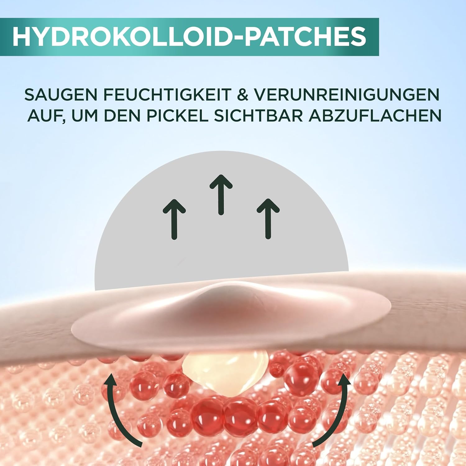 Demonstrates how the hydrocolloid patches absorb moisture and impurities to visibly reduce acne.