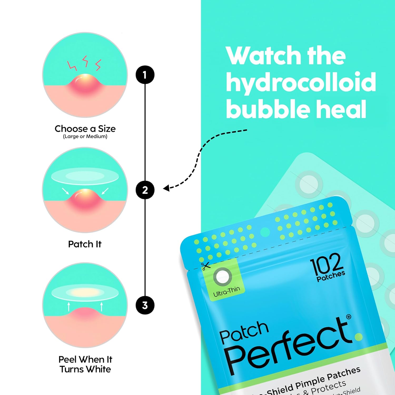 Infographics for PATCH PERFECT® Pimple Patch (Pack of 102) Invisible Hydrocolloid Pimple Patches