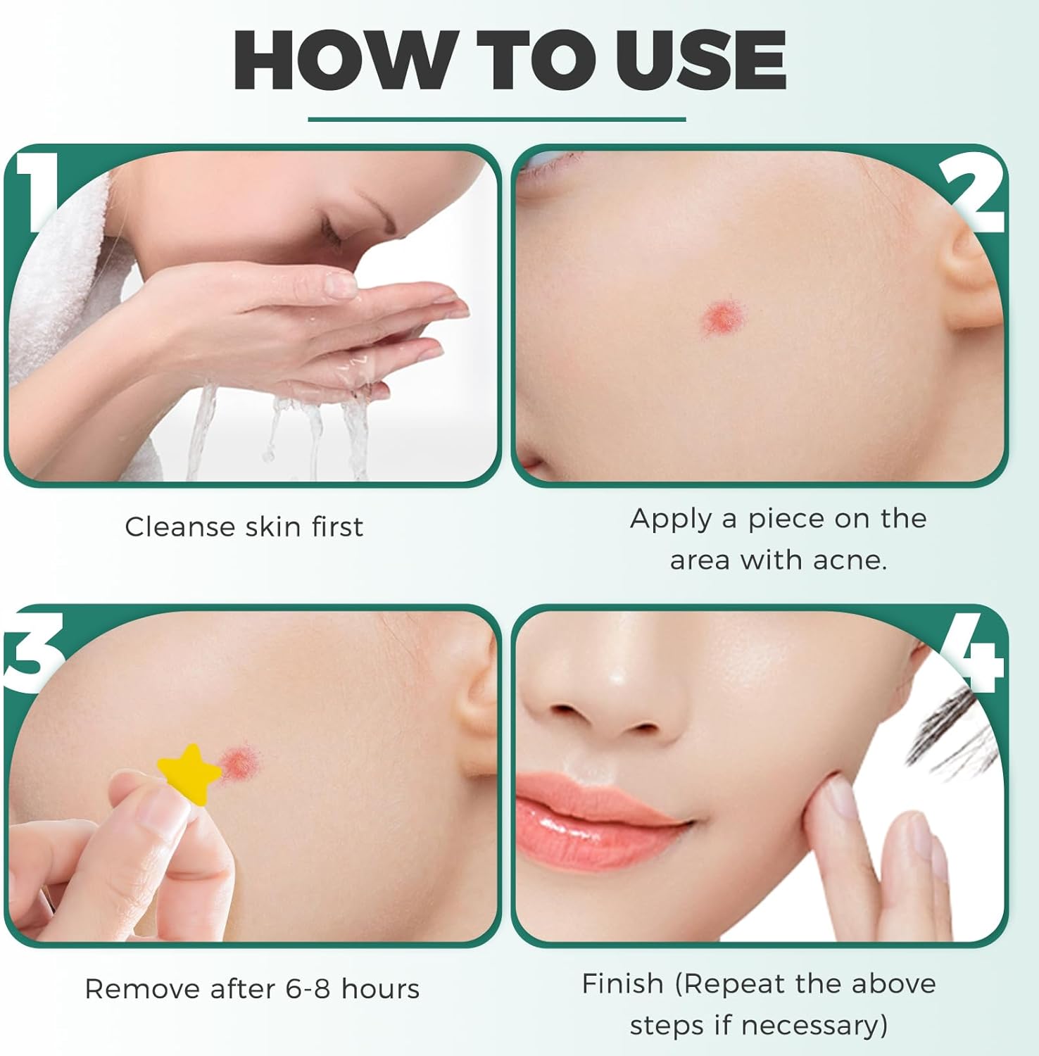 Provides step-by-step instructions on how to properly apply an acne treatment product, ensuring correct usage for best results.