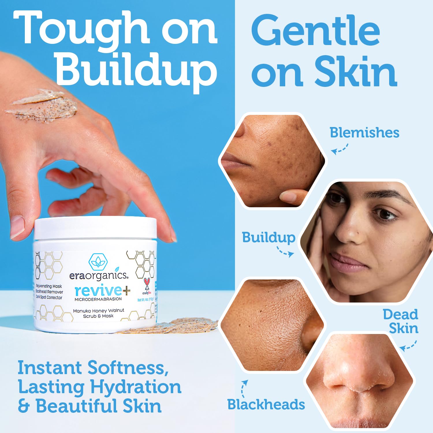 Highlights the product's ability to effectively remove skin buildup while being gentle on the skin, addressing multiple skin concerns like blemishes, blackheads, and dead skin.