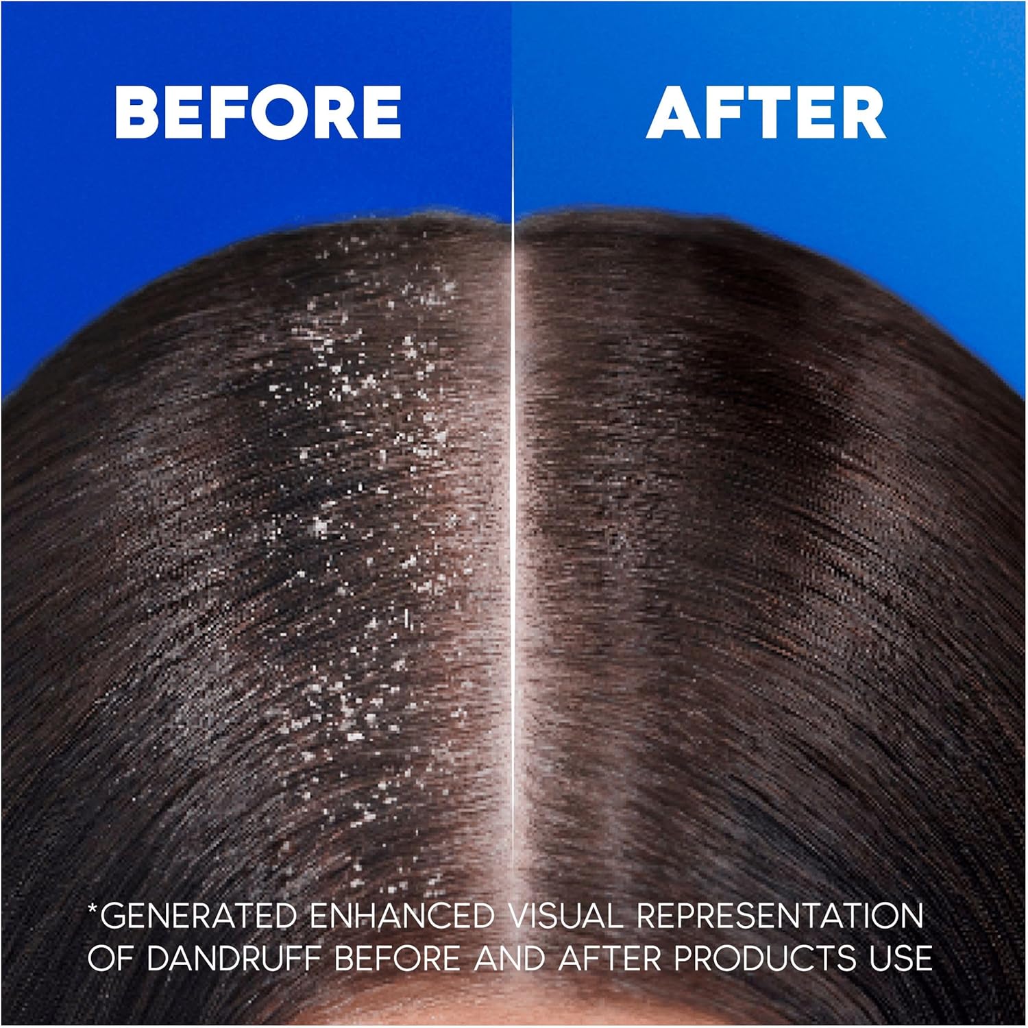 Demonstrates the effectiveness of the product in eliminating dandruff from the scalp.