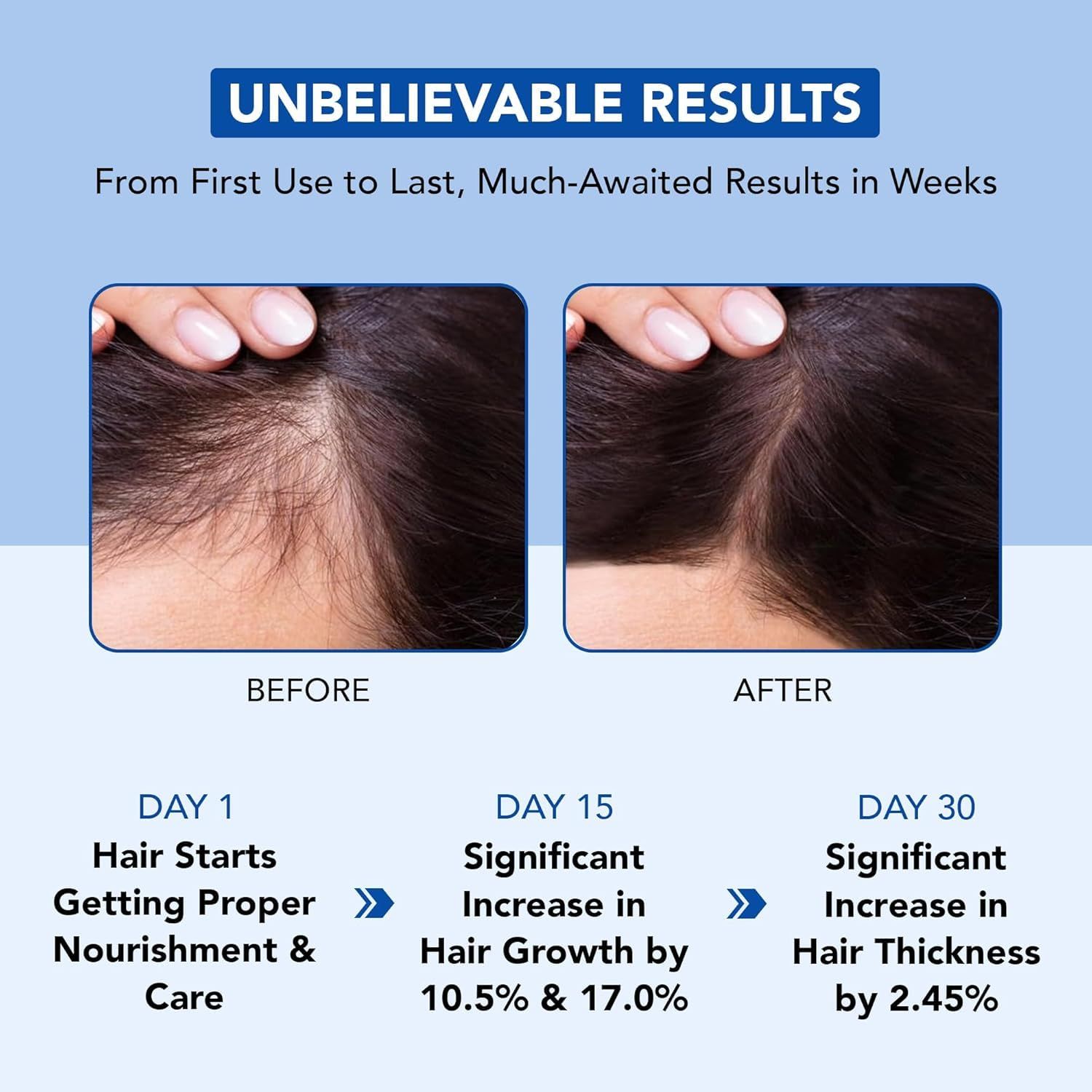 Demonstrates visible hair regrowth and increased thickness over 30 days to prove the product's effectiveness for hair loss treatment. Provides quantifiable results with specific percentages and…
