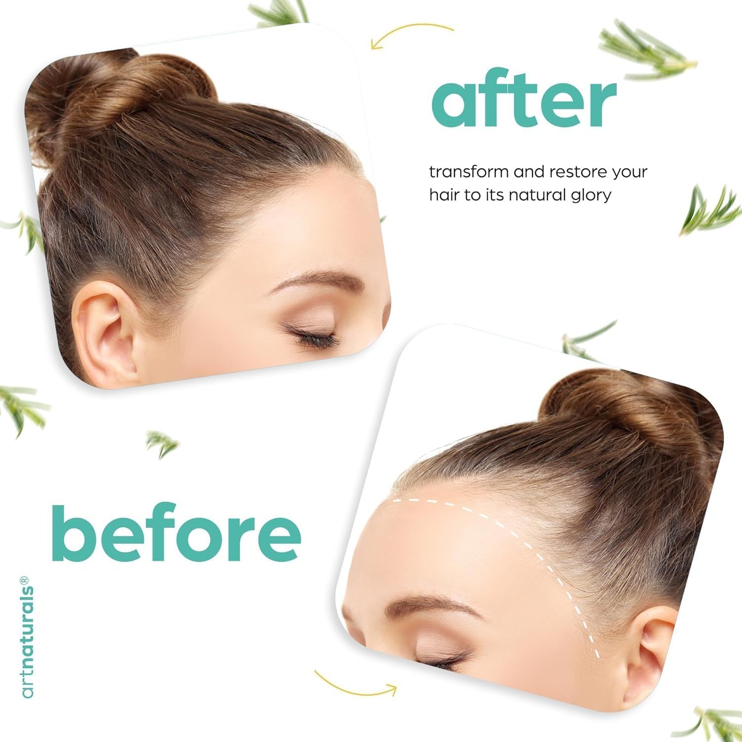 Demonstrates the transformation of hair from damaged or thinning to restored and healthy, showing visible improvement in hairline and overall hair appearance to prove product effectiveness.