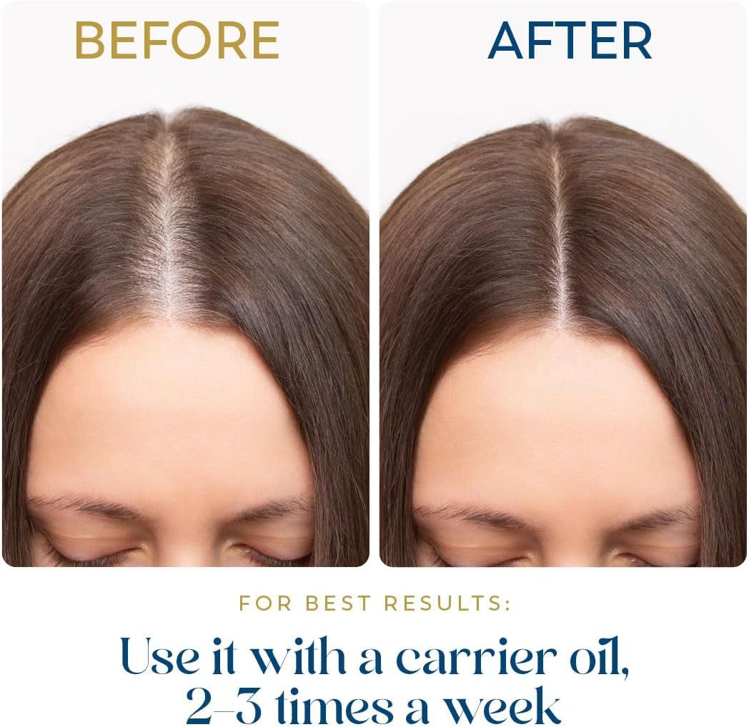 Demonstrates the visible transformation in hair coverage and scalp appearance after using the product, proving its effectiveness for hair-related concerns.