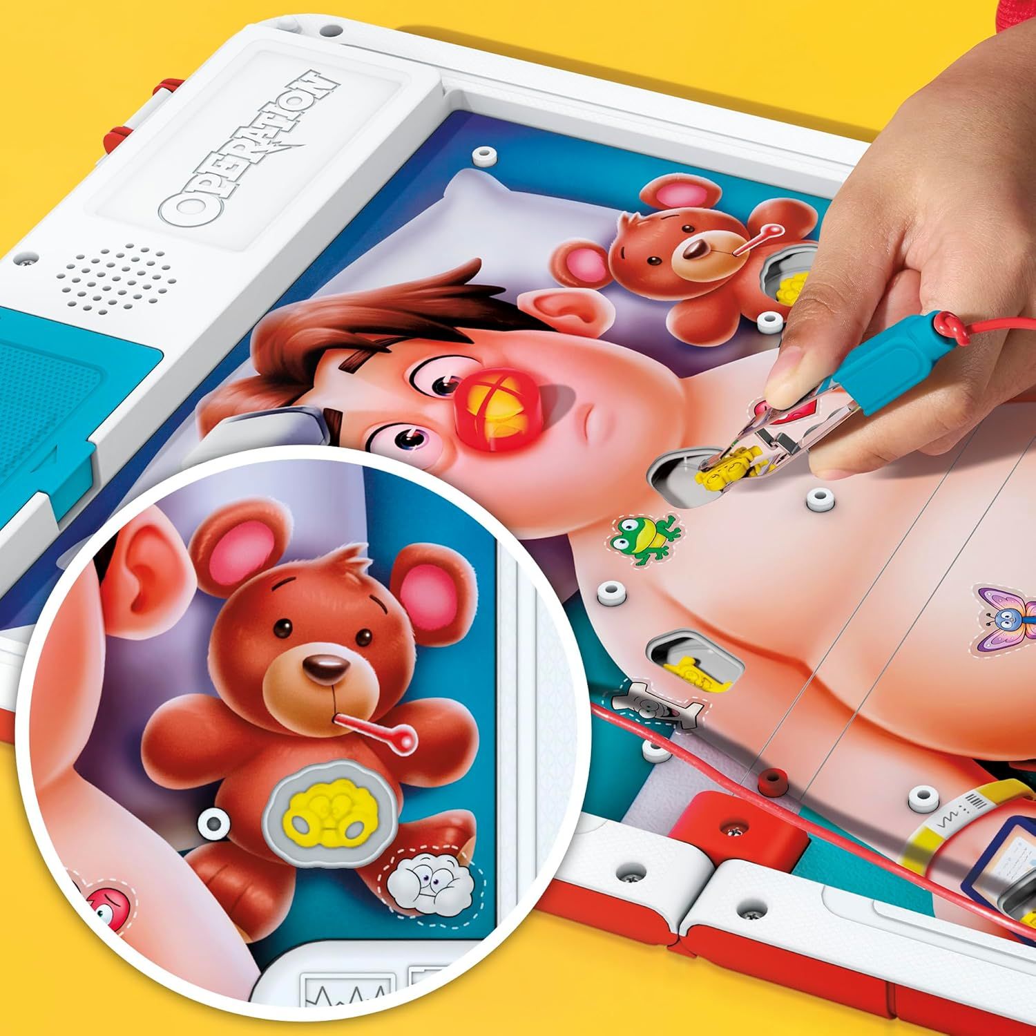 Demonstrates the interactive, hands-on nature of the Operation game with realistic surgical tools and engaging gameplay to show children how fun and immersive the experience is.