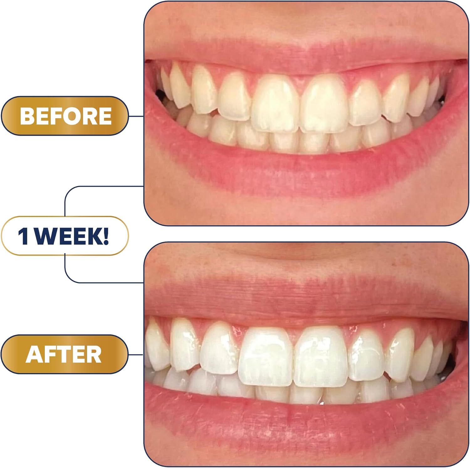 Demonstrates the visible whitening transformation achieved in just one week to prove product effectiveness and encourage purchase.