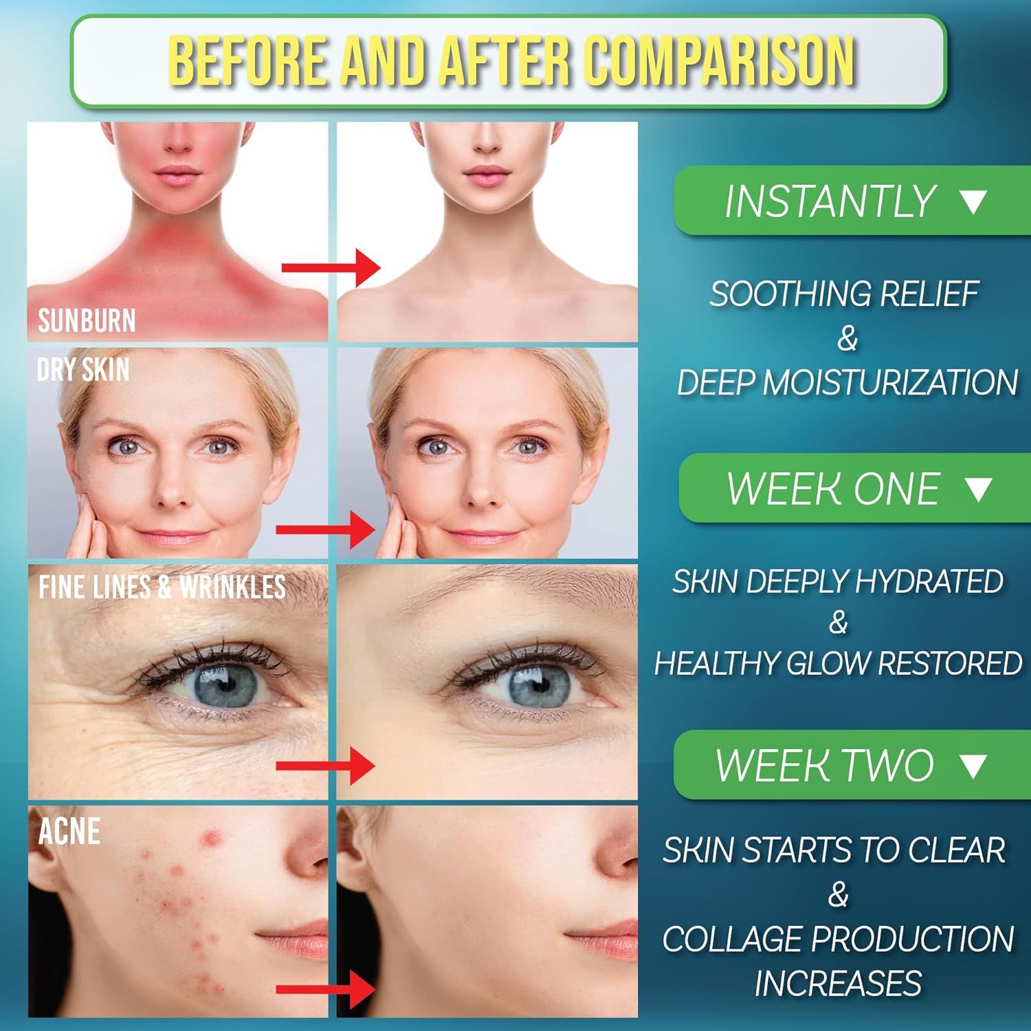 Demonstrates the transformative results of the skincare product across multiple skin concerns (sunburn, dryness, wrinkles, acne) with a timeline showing instant to two-week improvements to prove…