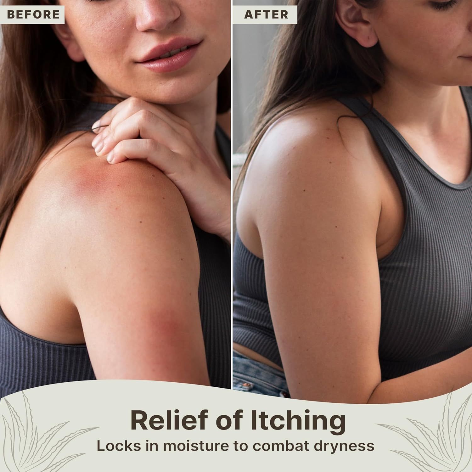 Demonstrates the product's effectiveness in relieving itching and dryness by showing a visual transformation of the skin from dry/irritated to smooth and moisturized.