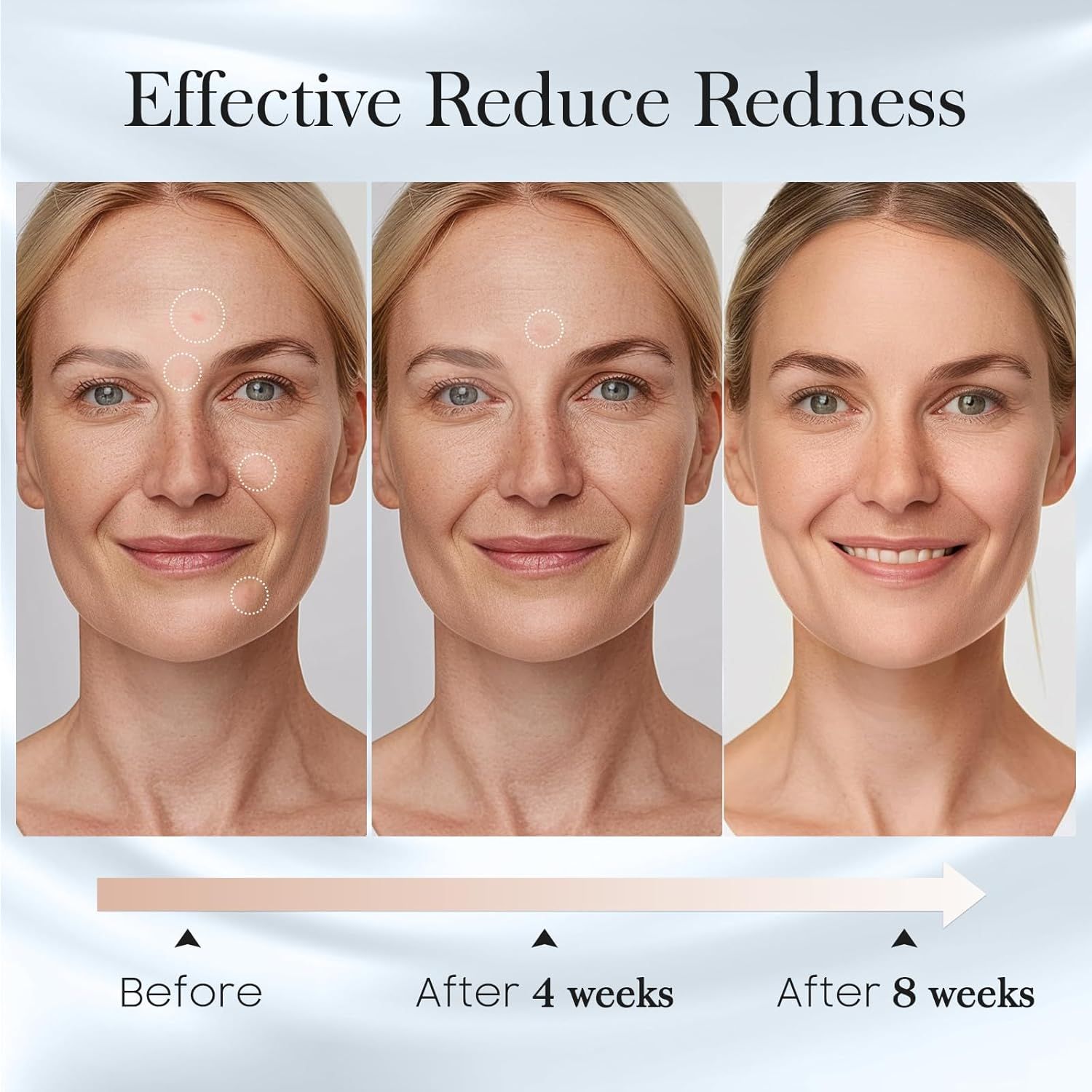 Demonstrates the product's effectiveness in reducing facial redness over time, showing progressive improvement at 4 weeks and 8 weeks to reassure shoppers of visible results.