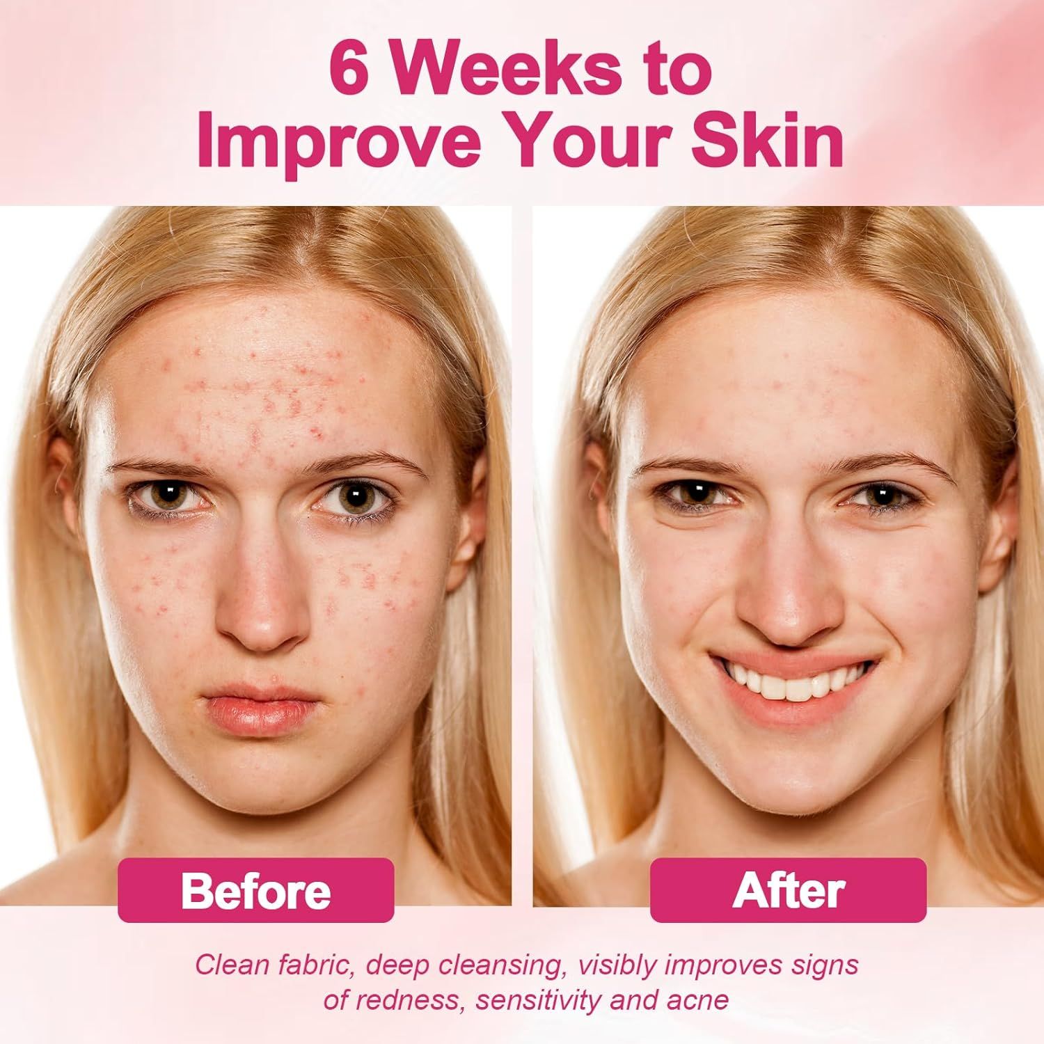 Demonstrates the visible transformation and effectiveness of the skincare product over 6 weeks, showing dramatic reduction in acne, redness, and sensitivity to reassure shoppers of proven results.