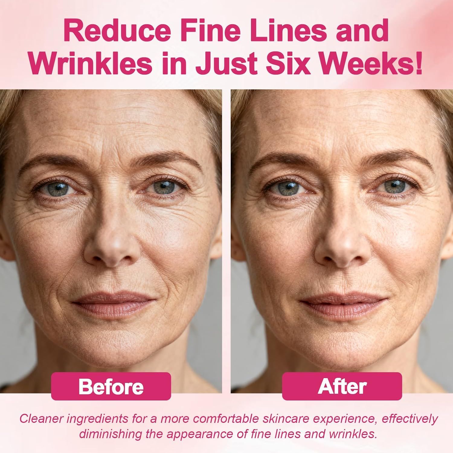 Demonstrates the visible transformation and effectiveness of the skincare product by showing reduced fine lines and wrinkles after six weeks of use, providing visual proof of results to build…