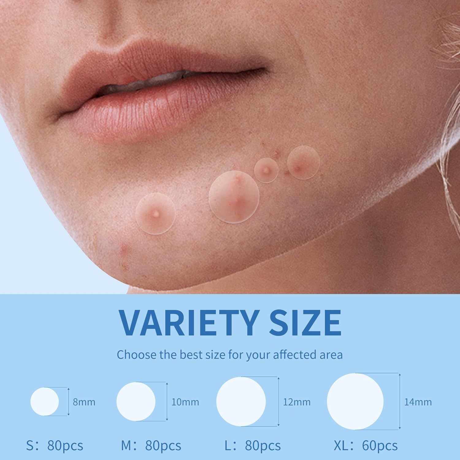 Demonstrates the different size options available (8mm, 10mm, 12mm, 14mm) to help shoppers choose the best size for their specific affected area, with quantity information for each size.