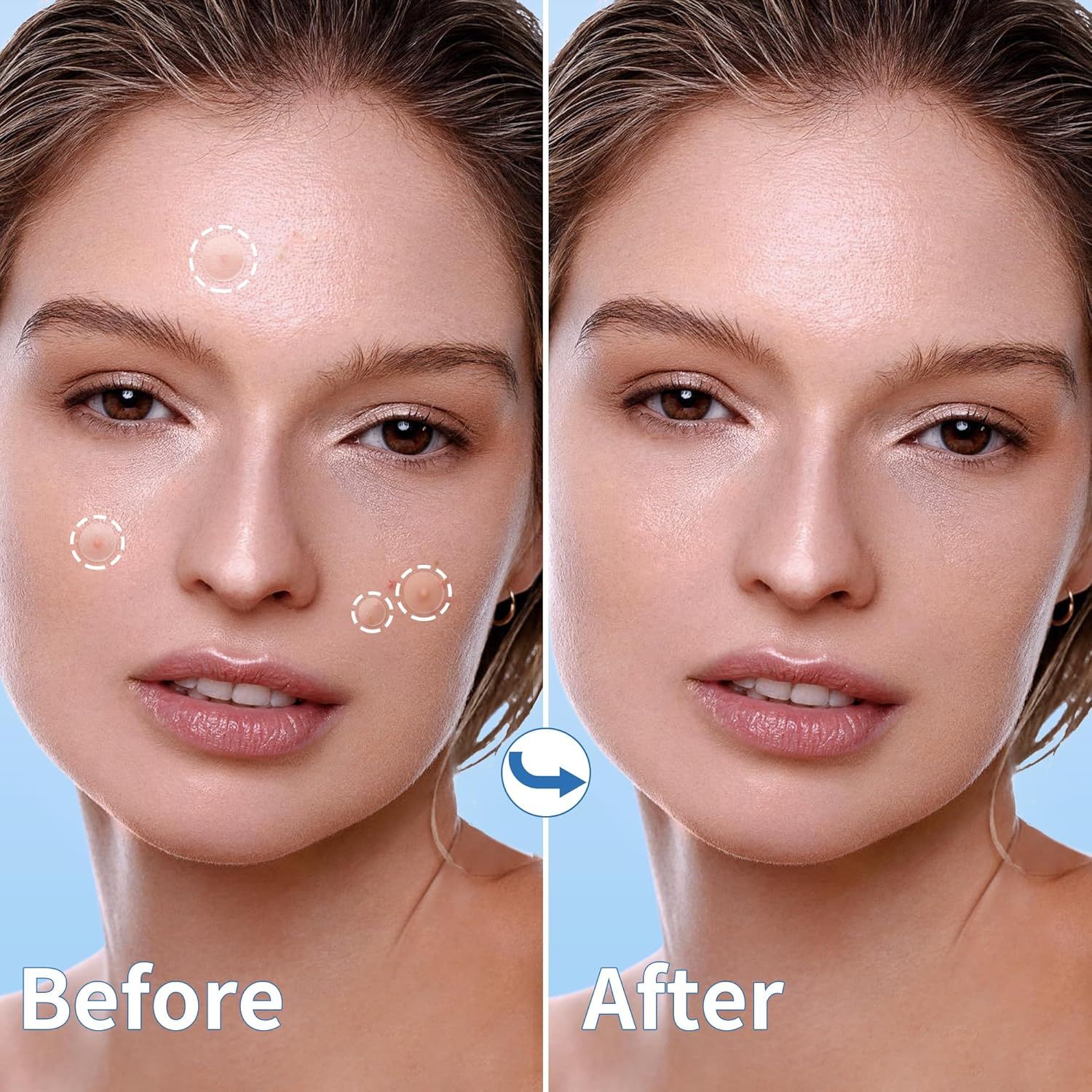 Demonstrates the product's effectiveness in reducing blemishes and improving skin texture, showing visible transformation from before to after use.